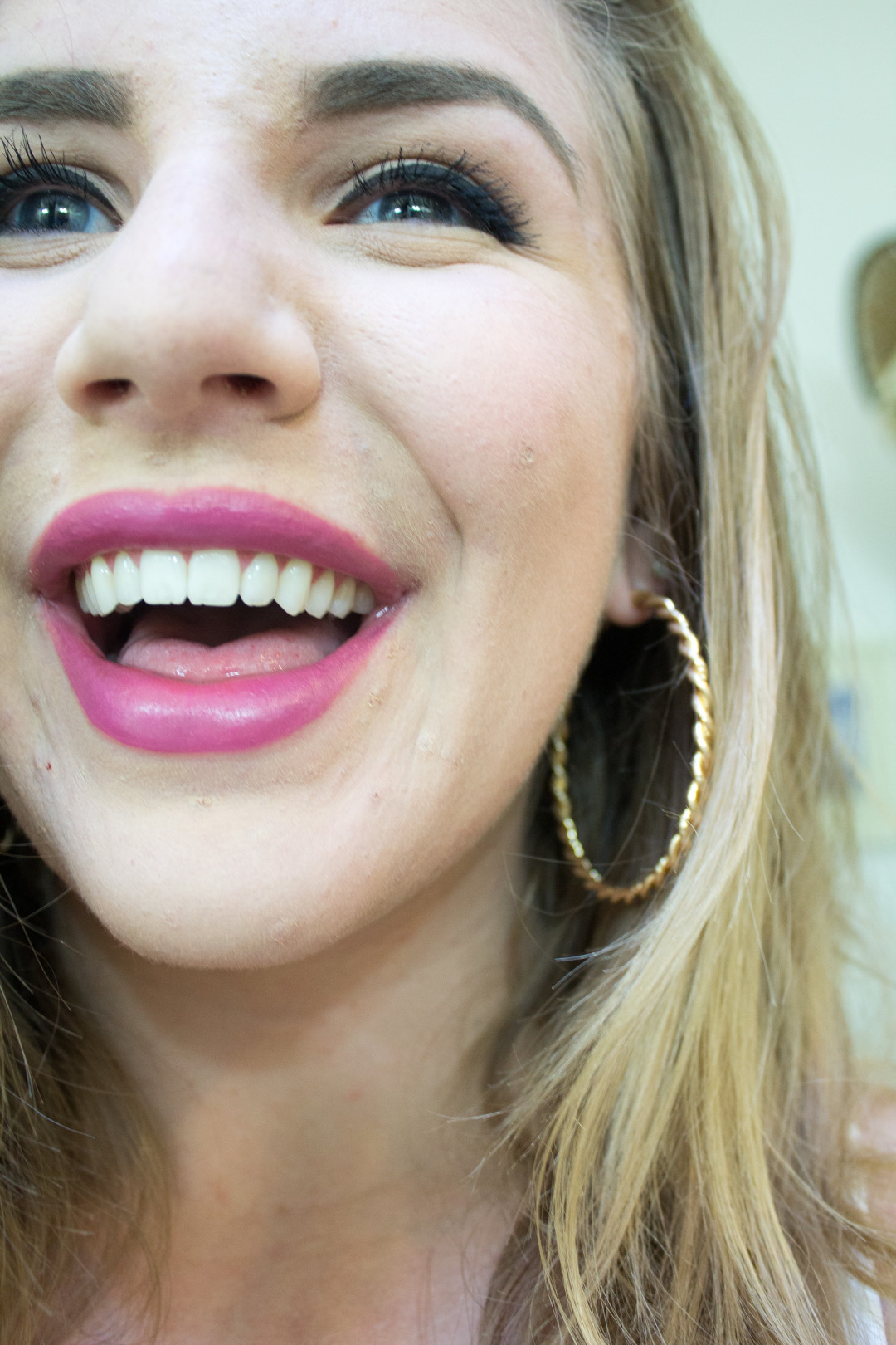 How to Whiten Very Yellow Teeth at Home | Seattle Stylista